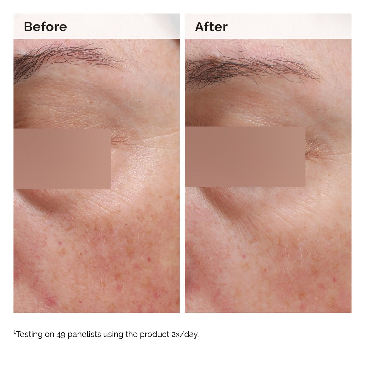5% Face and Body Emulsion - Simple Support