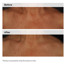 5% Face and Body Emulsion - Simple Support