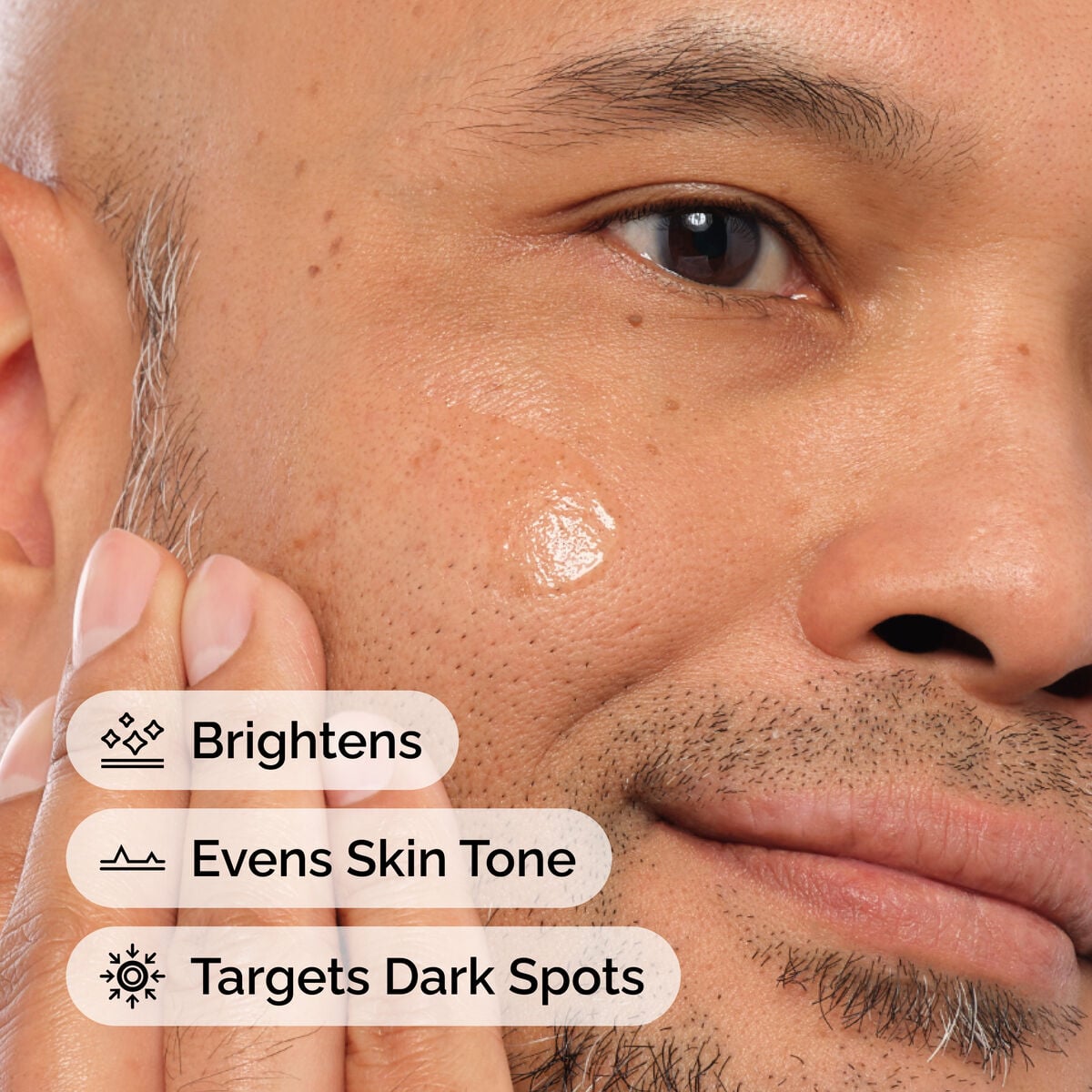 Alpha Arbutin 2% + HA - Skin Support