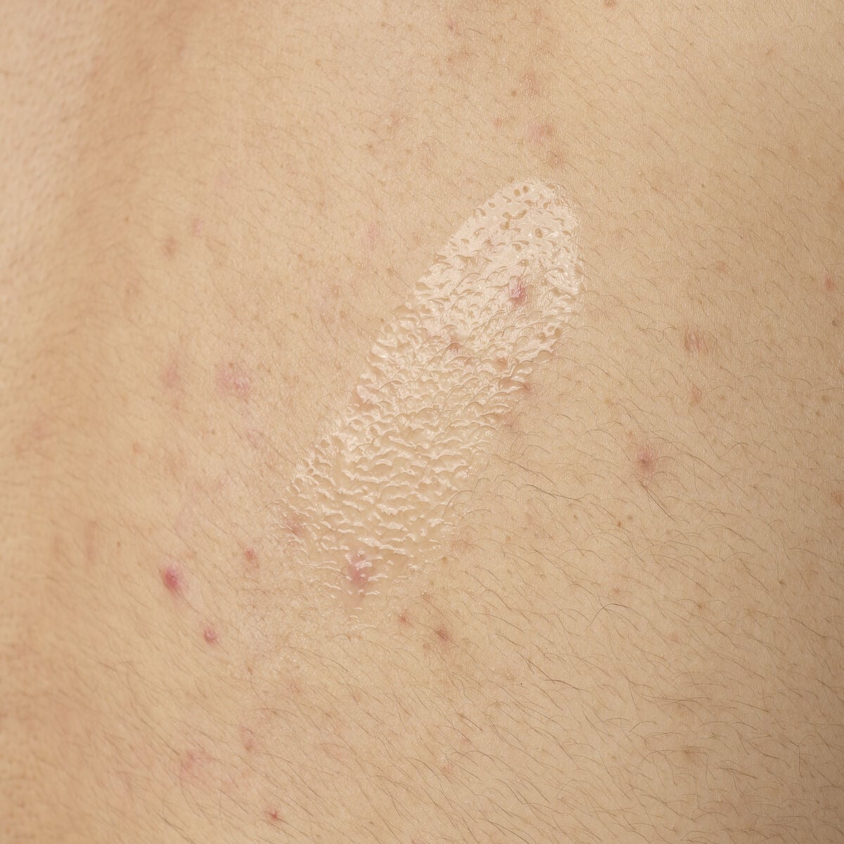 Acid 0.5% Body Serum - Bright Touch