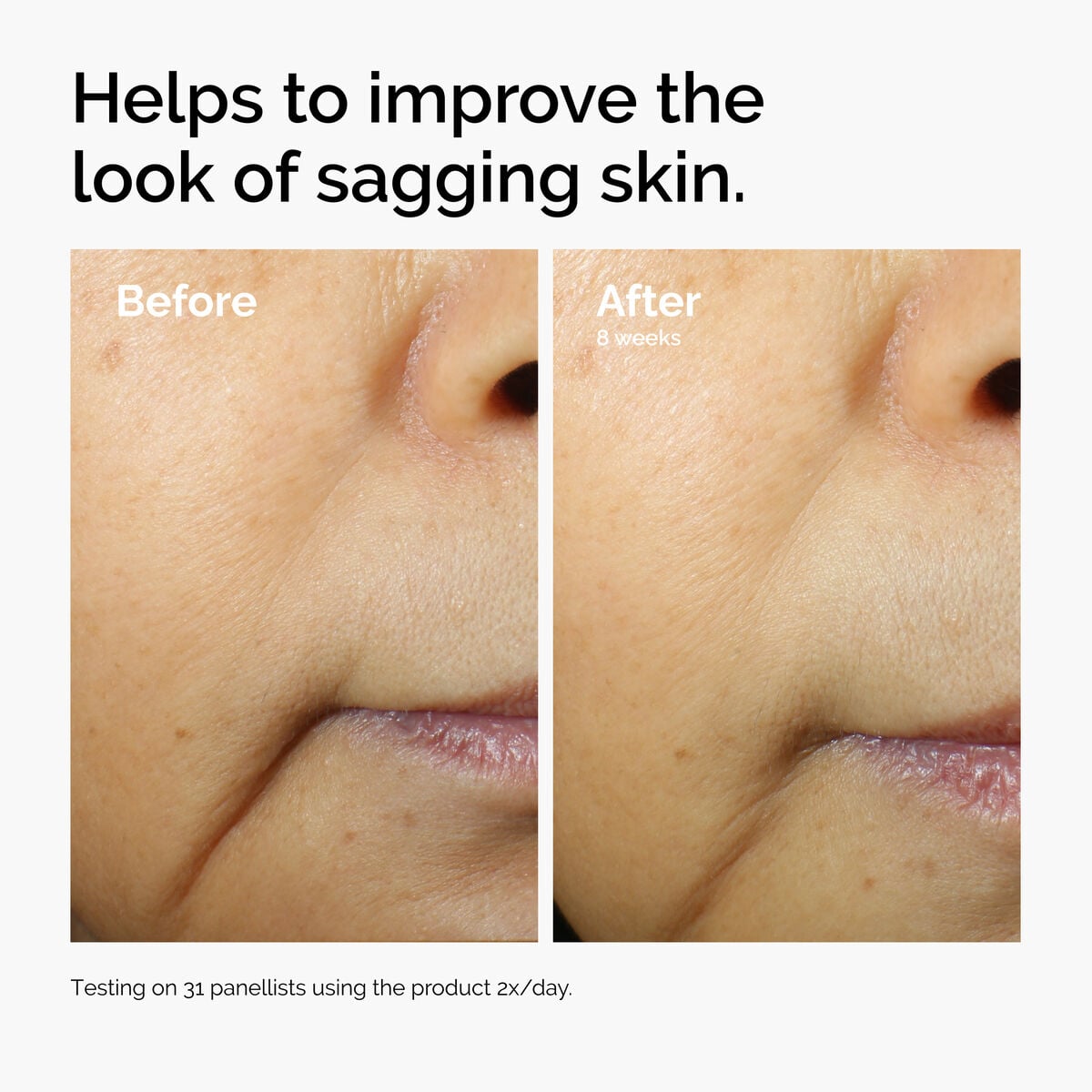 3% + Escin 1% Face Serum - Gentle Reset