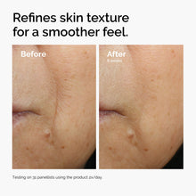 3% + Escin 1% Face Serum - Gentle Reset