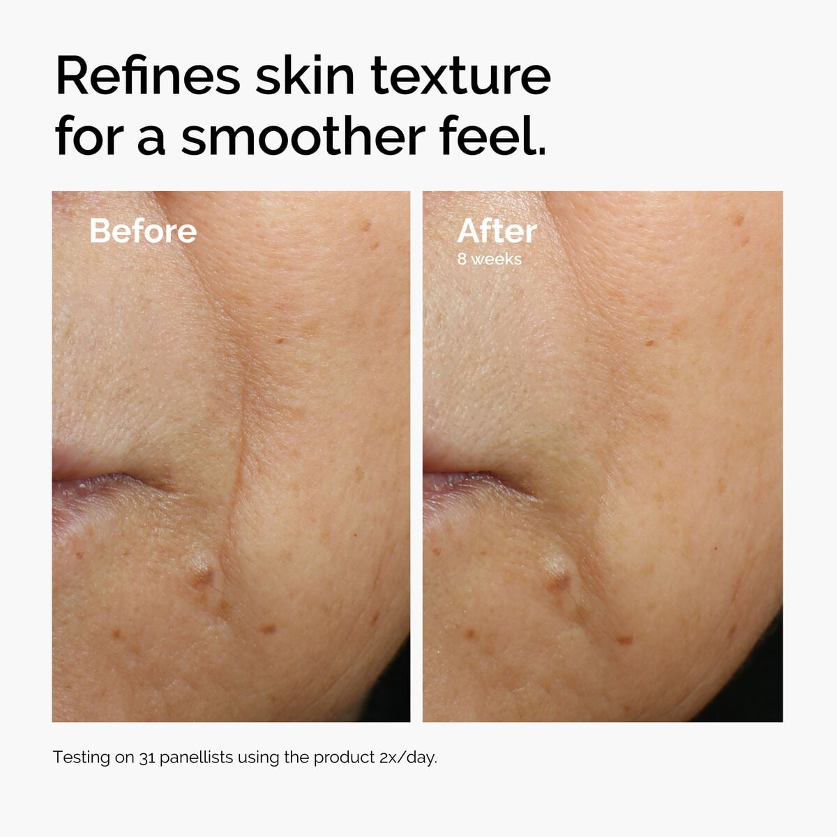 3% + Escin 1% Face Serum - Gentle Reset