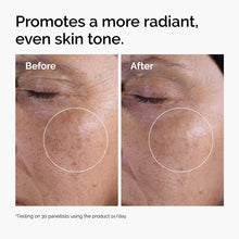 Acid 7% Exfoliating Toner - Home Choice