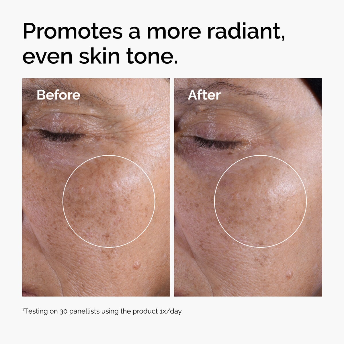 Acid 7% Exfoliating Toner - Home Choice