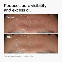 10% + Zinc 1% - Daily Glow