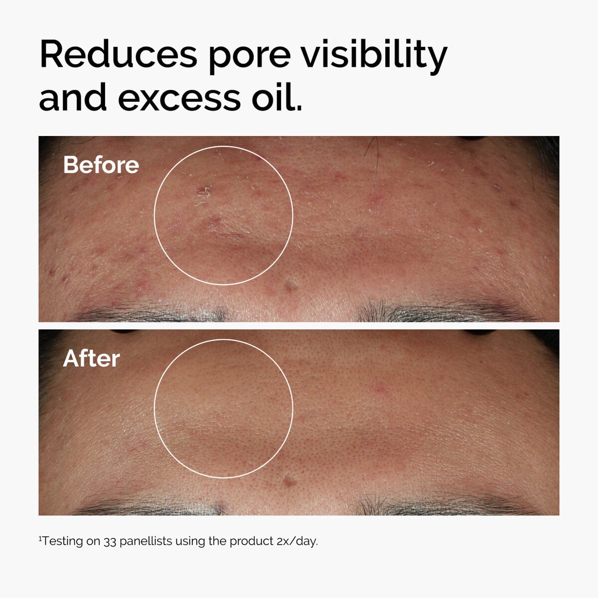 10% + Zinc 1% - Daily Glow
