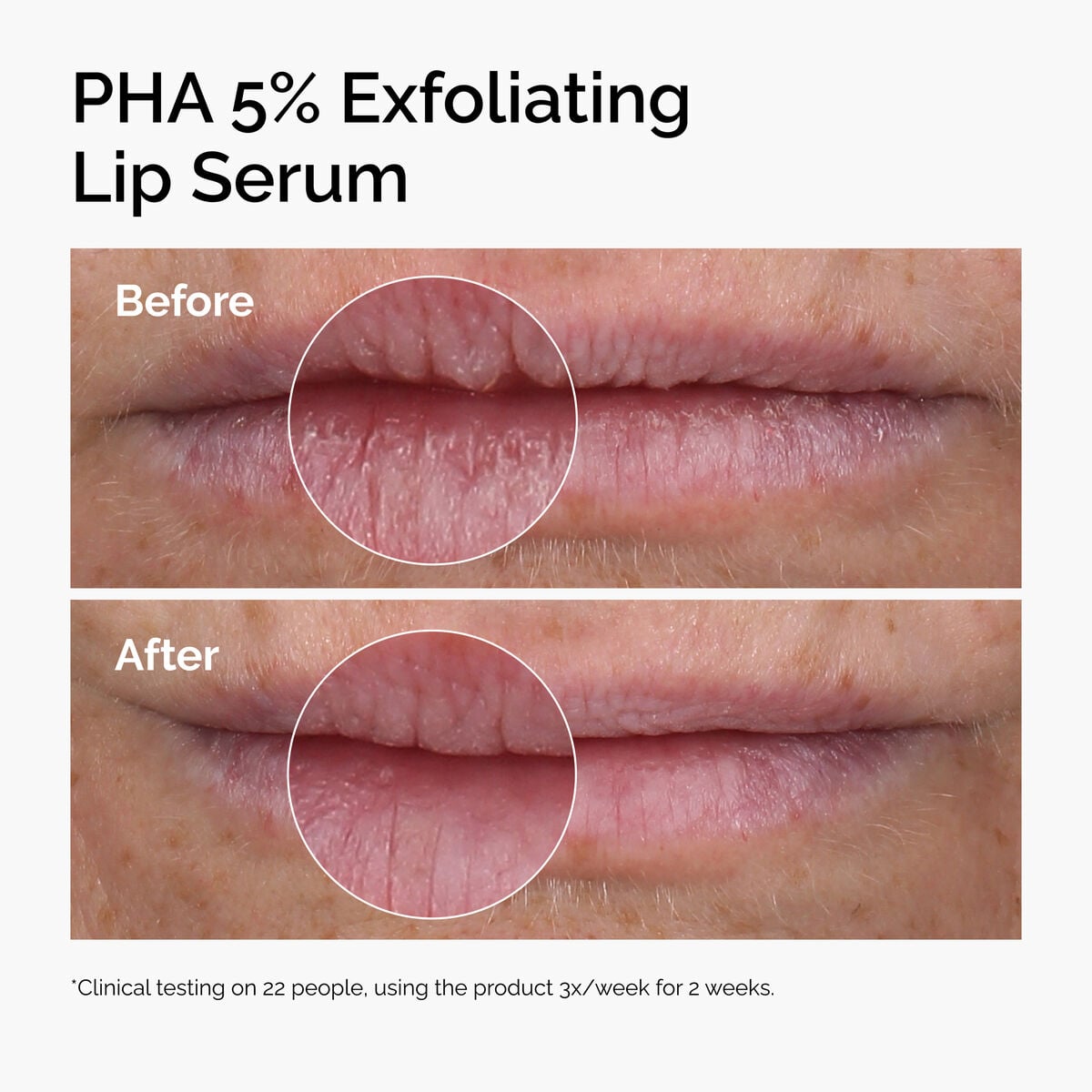 PHA 5% Exfoliating Lip Serum - Everyday Pop